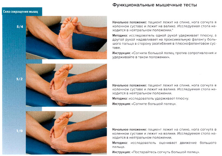 Функциональные мышечные тесты