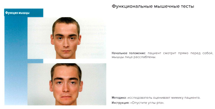 Функциональные мышечные тесты