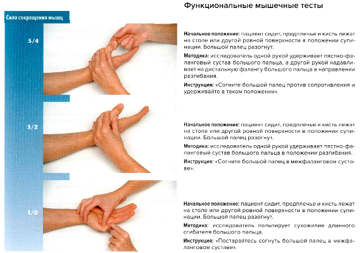 Функциональные мышечные тесты