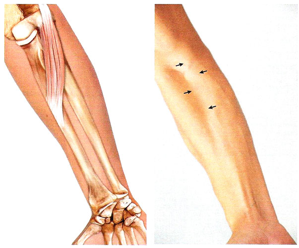 Файл:Mishci sport36.jpg