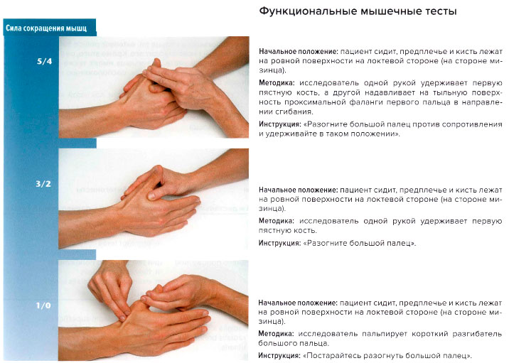 Функциональные мышечные тесты