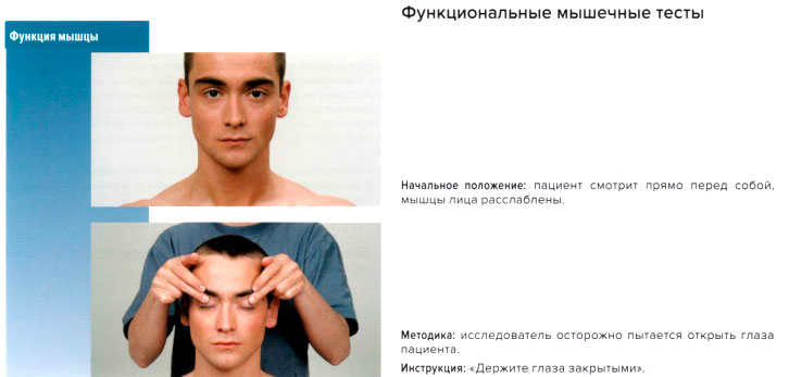 Функциональные мышечные тесты