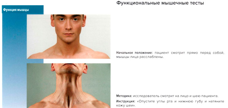 Функциональные мышечные тесты