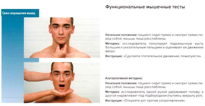 Функциональные мышечные тесты