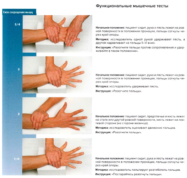 Функциональные мышечные тесты