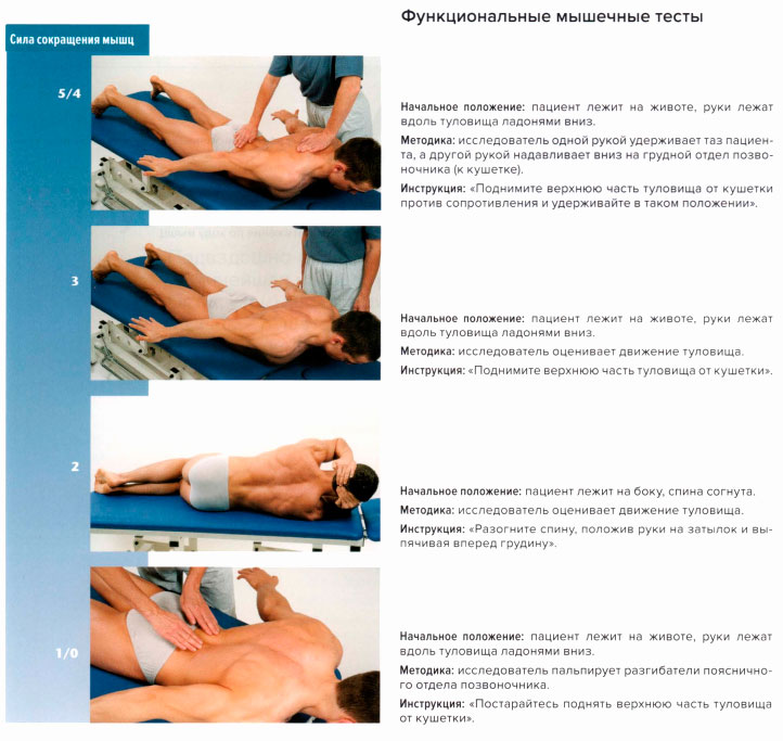 Функциональные мышечные тесты