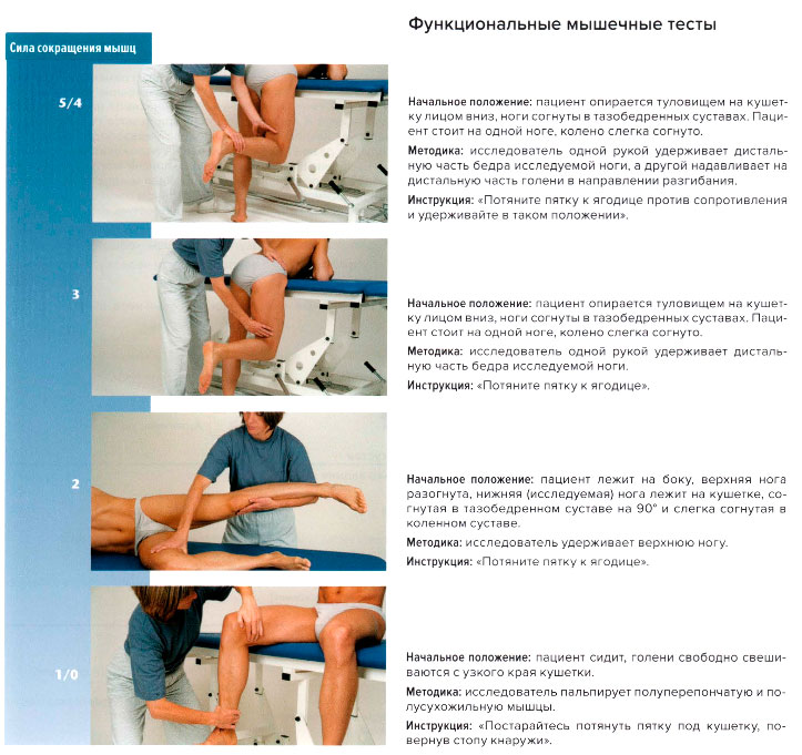 Функциональные мышечные тесты