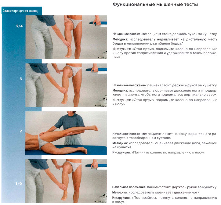 Функциональные мышечные тесты