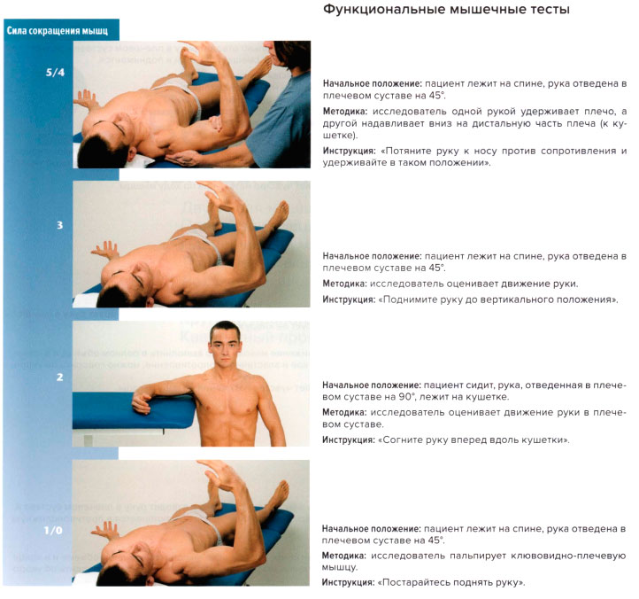 Функциональные мышечные тесты