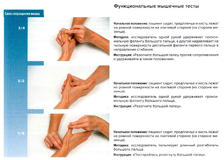 Функциональные мышечные тесты