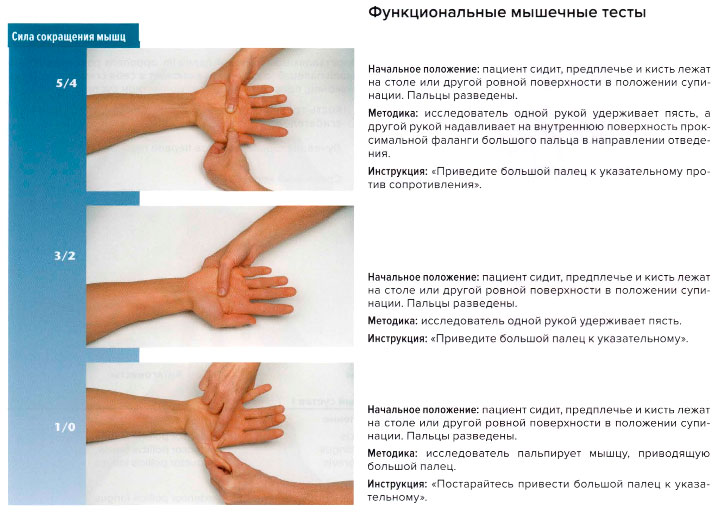 Функциональные мышечные тесты